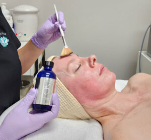 an esthetician giving a client a chemical peel